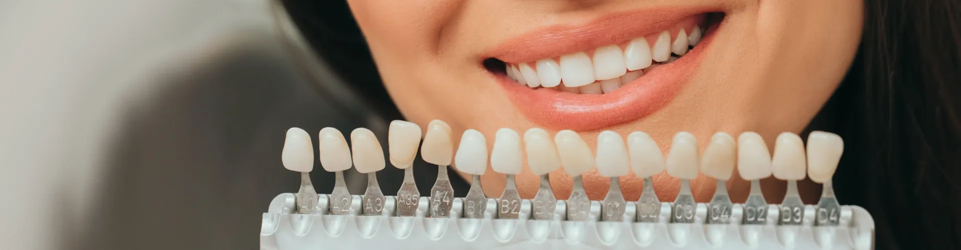 Tooth shade-matching tool in front of woman's smile.