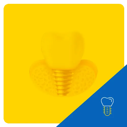 3D graphic of a dental implant with a tooth mounted on a screw-like post, set on a yellow honeycomb patterned base, symbolizing the dental implant process.