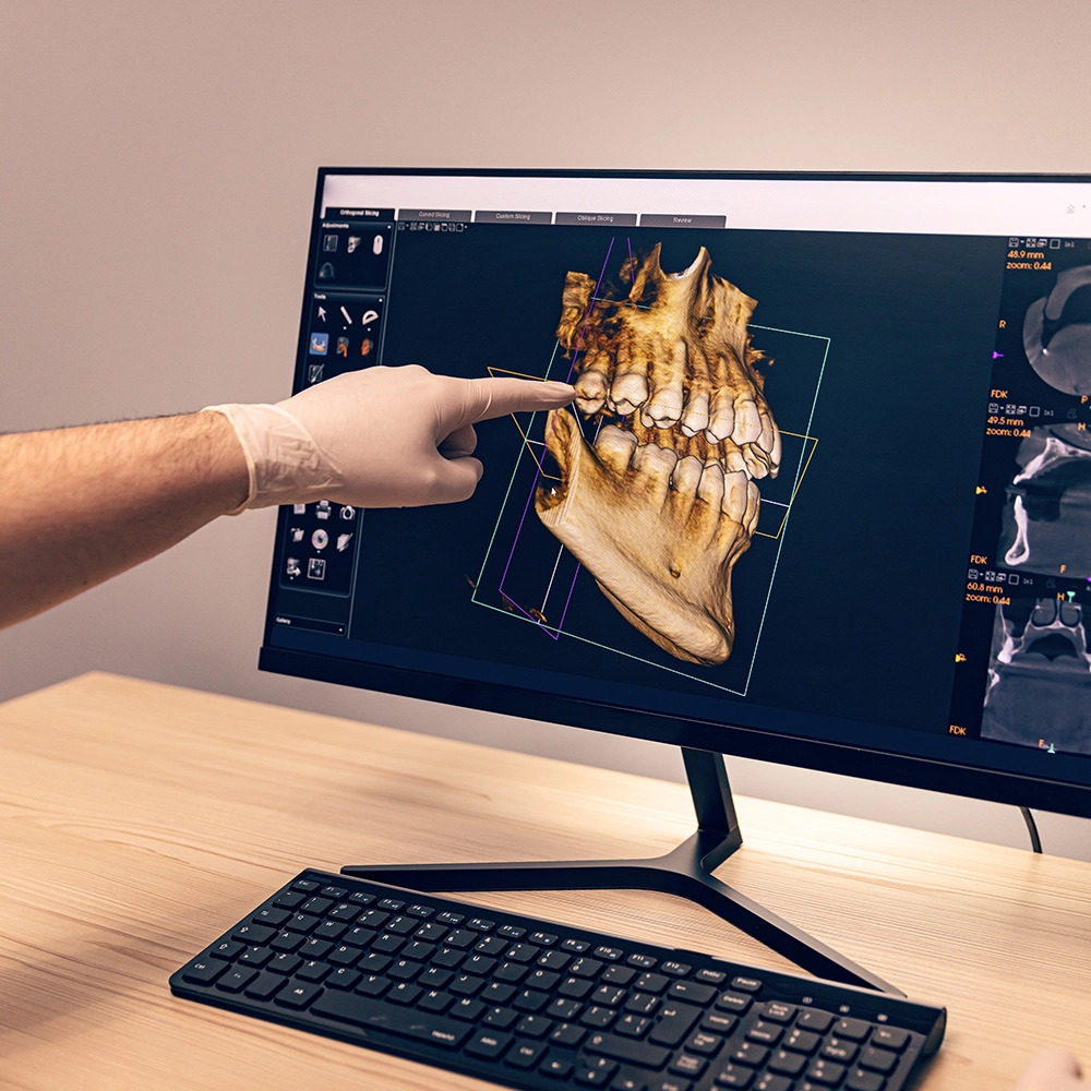 Dentist pointing at a screen displaying a full 3D image of a jaw with teeth.