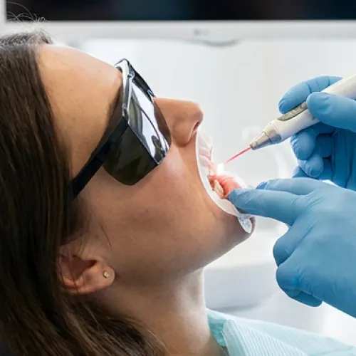 Patient undergoing laser gum contouring treatment while wearing protective eyewear as a dentist carefully reshapes the gumline to improve smile aesthetics and oral health.
