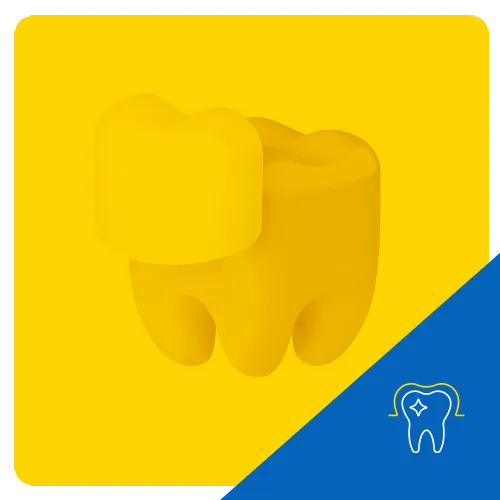 3D graphic of a tooth covered by a veneer, set against a yellow background, representing cosmetic dental treatment with veneers.