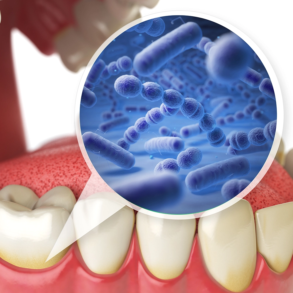 3D rendering of teeth with a speech bubble showing a 3D illustration of bacteria coming from one tooth.