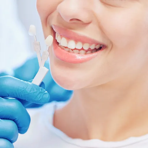 Gloved hand holding tooth shade-matching tool against woman's smile.