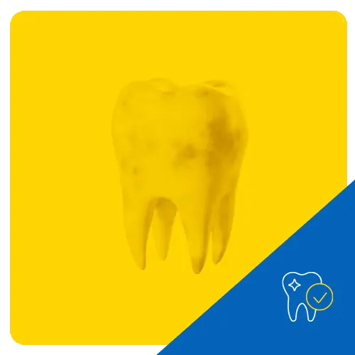 3D graphic of a molar tooth with visible stains on a vibrant yellow background, highlighting dental discoloration.