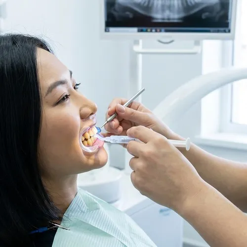 Dentist applying teeth whitening gel to a patient's teeth.