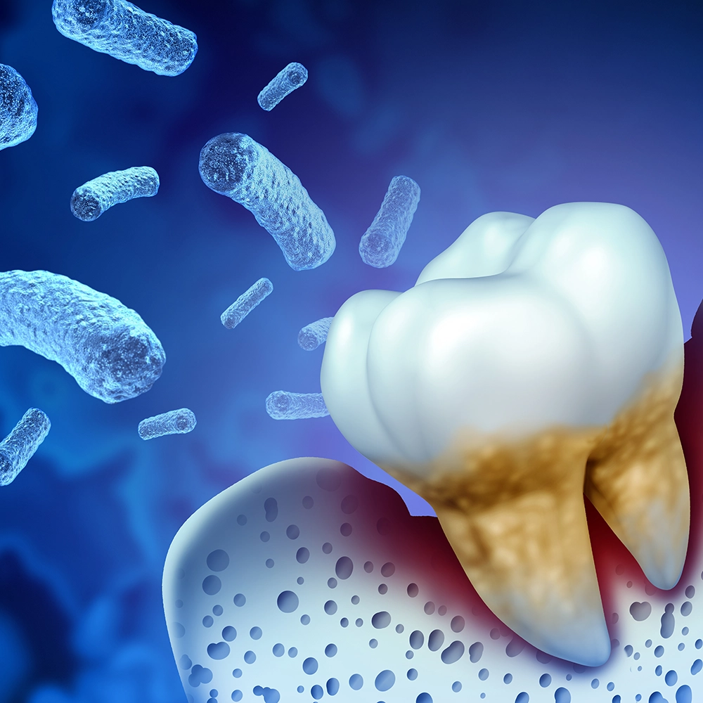 3D rendering of a tooth surrounded by bacteria on a blue background.