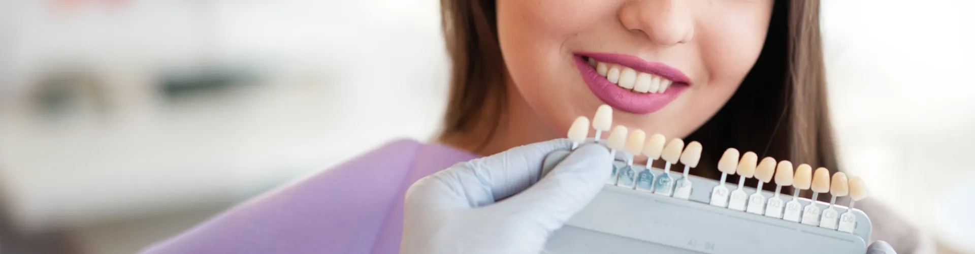 Dentist holding a shade guide to match dental veneers for a patient smile makeover.