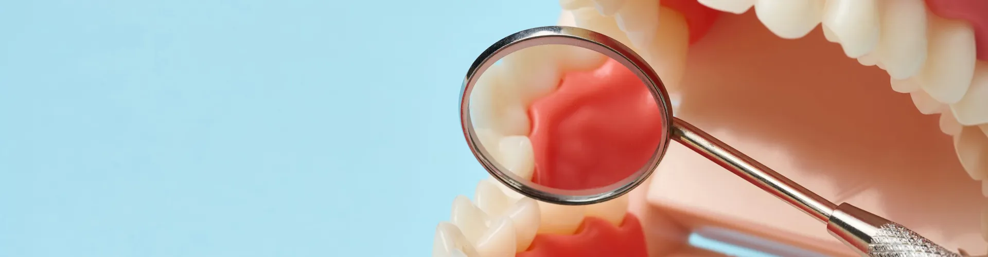 Dental mirror showing healthy-looking gums and teeth during an oral examination.