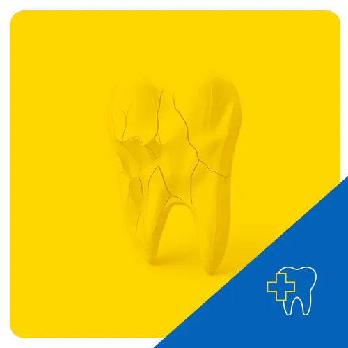 3D illustration of a cracked molar on a yellow background, symbolizing dental trauma.