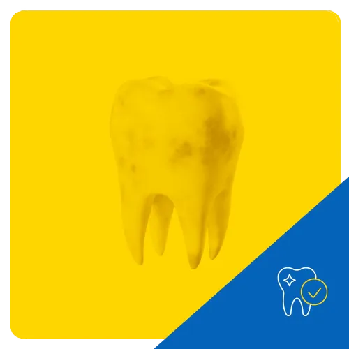 3D graphic of a molar tooth with visible stains on a vibrant yellow background, highlighting dental discoloration.