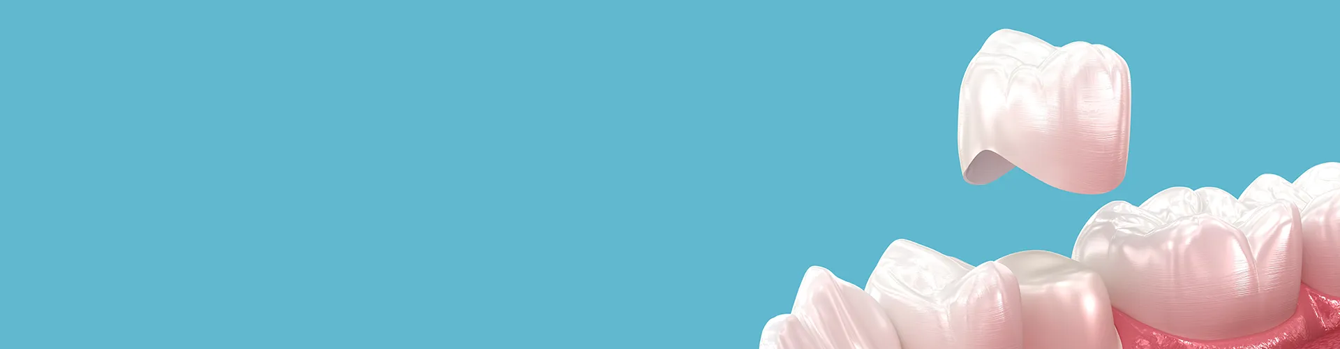 rendering of a white dental crown hovering above a filed-down tooth
