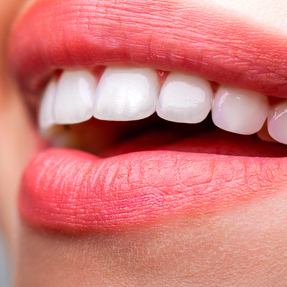Close-up of a woman's smile showing her teeth.