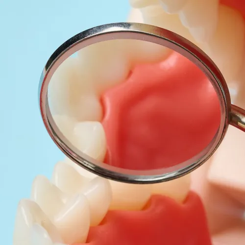 Dental mirror showing healthy-looking gums and teeth during an oral examination.