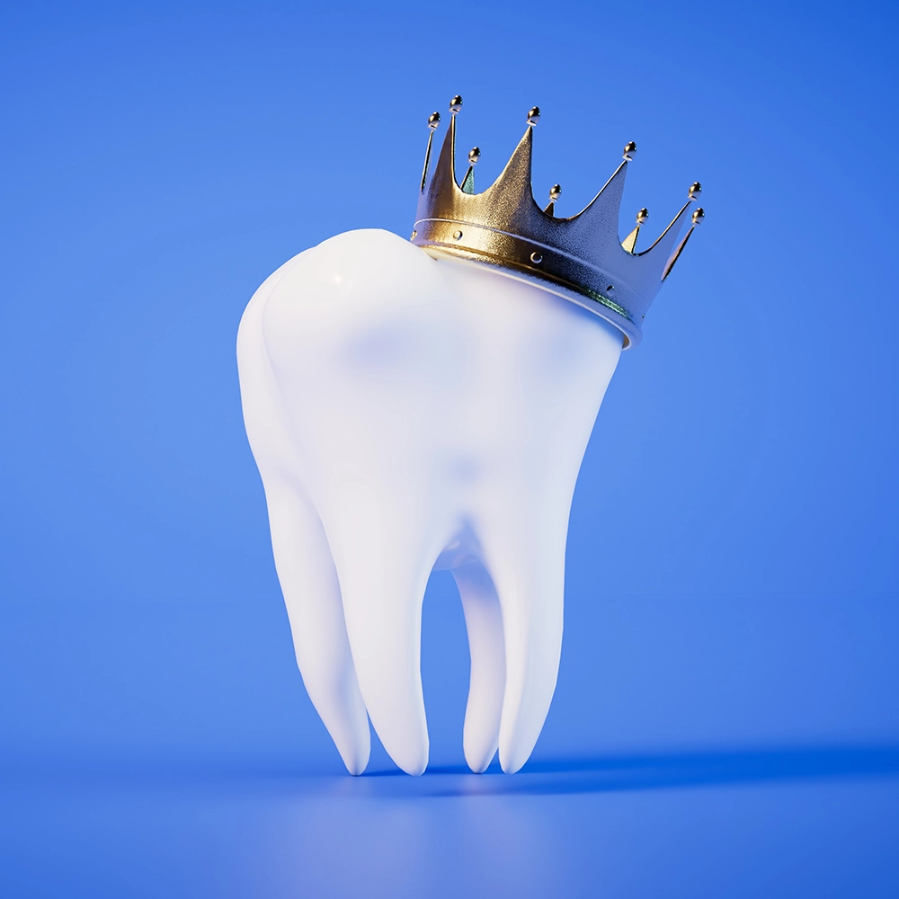 3D rendering of a tooth with a gold crown on top.