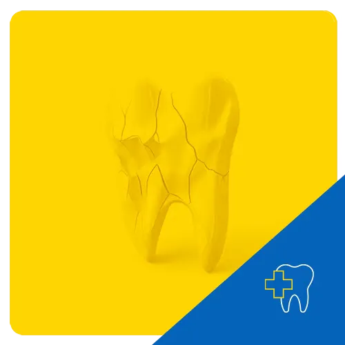 3D illustration of a cracked molar on a yellow background, symbolizing dental trauma.