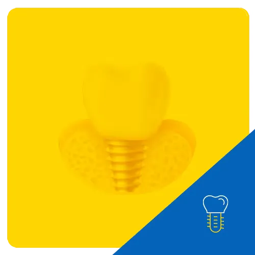 3D graphic of a dental implant with a tooth mounted on a screw-like post, set on a yellow honeycomb patterned base, symbolizing the dental implant process.