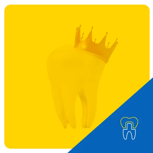 Crowns & Bridges