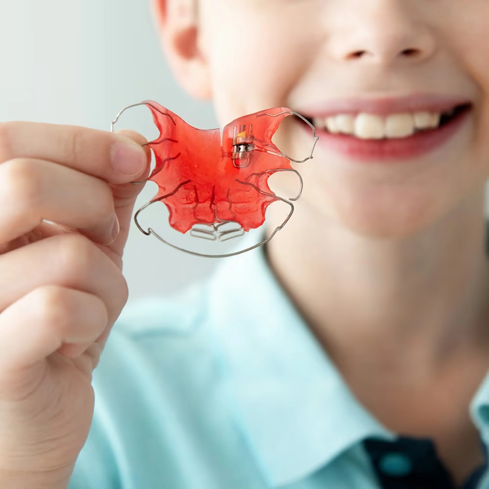 Close-up of a child holding a palatal expander, smiling, with their face blurred in the background.